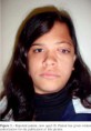 /album/fotogaleria/el-sindrome-de-goldenhar-tambien-conocido-como-oculo-auriculo-vertebral-oav-el-sindrome-jpg/